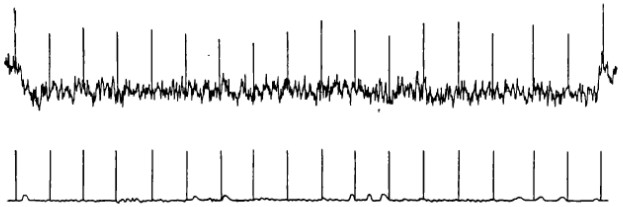 Signal forma